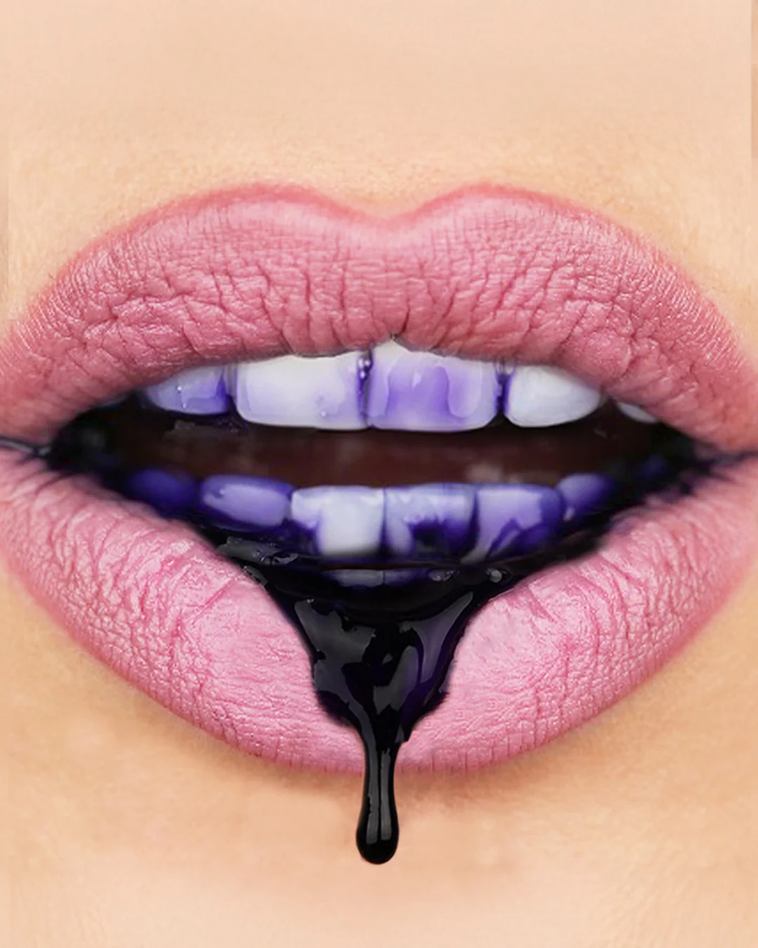 Ljubičasti Serum Za Izbeljivanje Zuba - Image 5